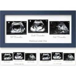 KeaBabies Trio Baby Sonogram Picture Frame, Baby Ultrasound Picture Frames For Baby Nursery, Mom To Be Gifts 23 KeaBabies Trio Baby Sonogram Picture Frame, Baby Ultrasound Picture Frames For Baby Nursery, Mom To Be Gifts -Lamps and Lighting Store GUEST 0d39649d 6126 4bba b217 1b917313aa7c