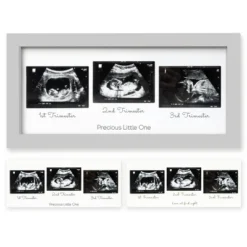 KeaBabies Trio Baby Sonogram Picture Frame, Baby Ultrasound Picture Frames For Baby Nursery, Mom To Be Gifts 22 KeaBabies Trio Baby Sonogram Picture Frame, Baby Ultrasound Picture Frames For Baby Nursery, Mom To Be Gifts -Lamps and Lighting Store GUEST 3bf25d41 c634 498c 84e3 c83dfec65ad0