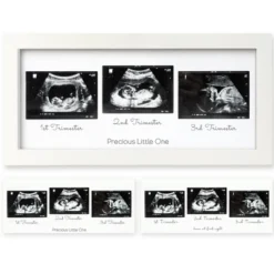 KeaBabies Trio Baby Sonogram Picture Frame, Baby Ultrasound Picture Frames For Baby Nursery, Mom To Be Gifts 20 KeaBabies Trio Baby Sonogram Picture Frame, Baby Ultrasound Picture Frames For Baby Nursery, Mom To Be Gifts -Lamps and Lighting Store GUEST c8d682a4 195b 4175 a0a5 f4e027afd6f2